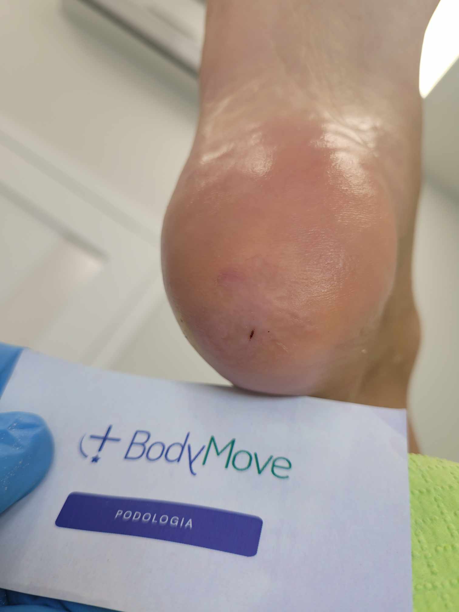 Pękające pięty Kraków